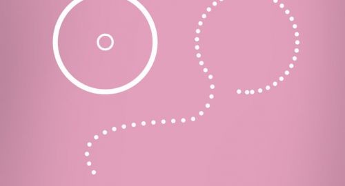 MARCHA CONTRA EL CÁNCER DE MAMA