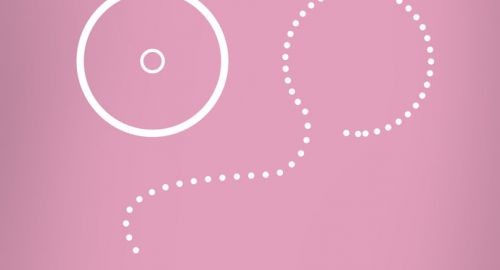 MARCHA CONTRA EL CÁNCER DE MAMA